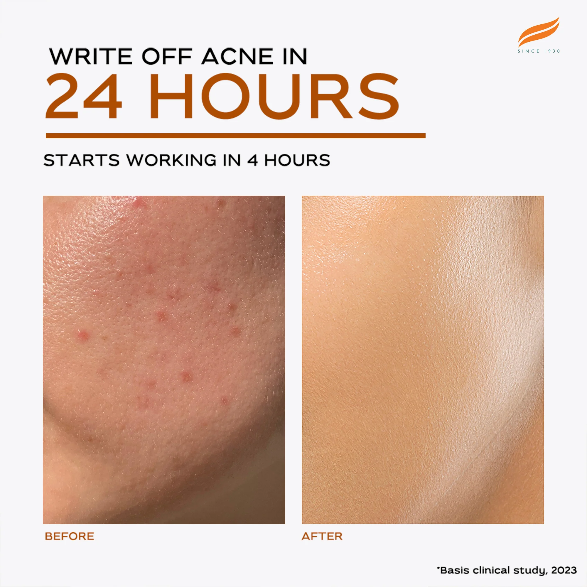 Acne Clear+ Treatment Pen - Image 9