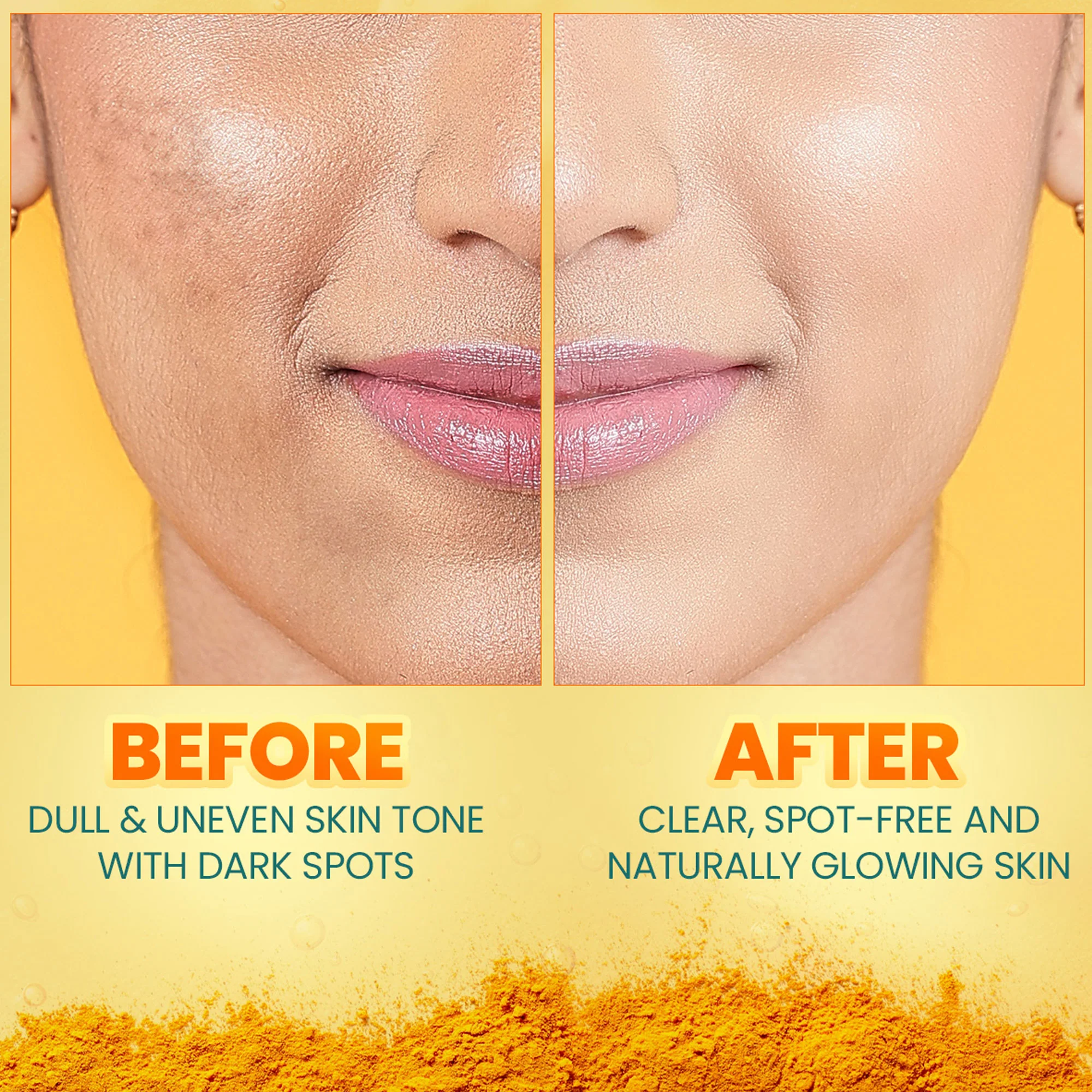 Dark Spot Clearing Turmeric Kit - Image 6